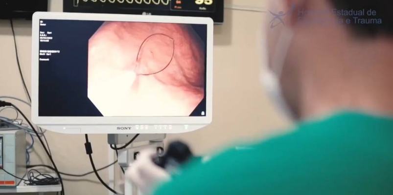 Hospital de Trauma de João Pessoa realiza procedimento cirúrgico-endoscópico