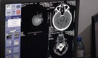 as-imagens-do-novo-tomografo-sao-muito-mais-precisas.jpg