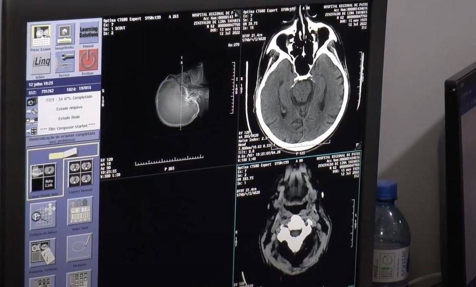 as-imagens-do-novo-tomografo-sao-muito-mais-precisas.jpg