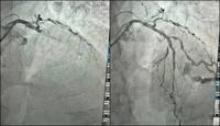 coracao-paraibano_-hemodinamica-do-regional-de-patos-e-palco-da-primeira-angioplastia-coronariana-do-sertao-paraibano-4.jpg
