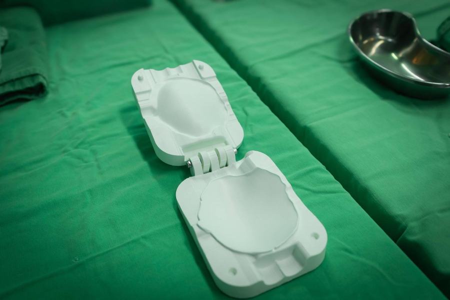 cranioplastia-com-protese-prototipada-4.jpeg