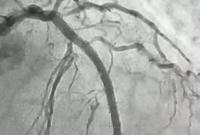 hemodinamica-de-patos-realiza-procedimento-cardiovascular-inedito-1.jpeg