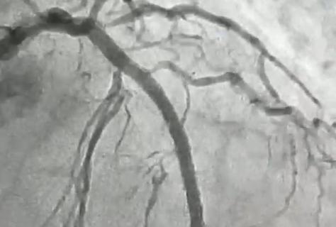 hemodinamica-de-patos-realiza-procedimento-cardiovascular-inedito-1.jpeg