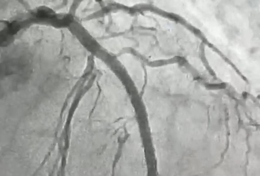 hemodinamica-de-patos-realiza-procedimento-cardiovascular-inedito-1.jpeg
