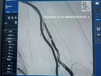 hemodinamica-gerenciada-pela-pb-saude-realiza-procedimento-endovascular-inedito-em-paciente-renal-3.jpeg