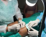 nesta-quarta-feira-foram-realizados-32-pquenas-cirurgias-no-hospital-de-catole.jpg