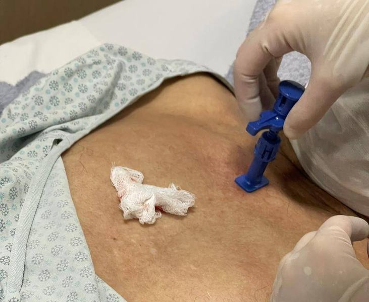 o-mielograma-e-feito-em-ambulatorio-pelo-hematologista.jpg