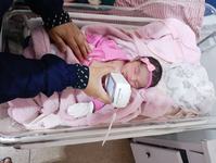 pb-saude-moderniza-diagnosticos-neonatais-com-bilirrubinometros-no-hrg-e-hsger-3.jpeg