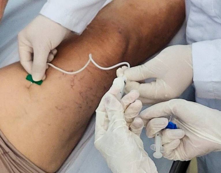 vascular_aplicacao_espuma_dr-rodrigo-2-close-1.jpg