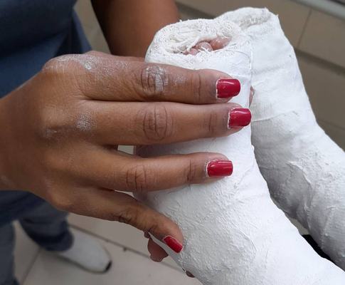 Hospital de Clínicas inicia consultas para cirurgias ortopédicas pelo Opera Paraíba
